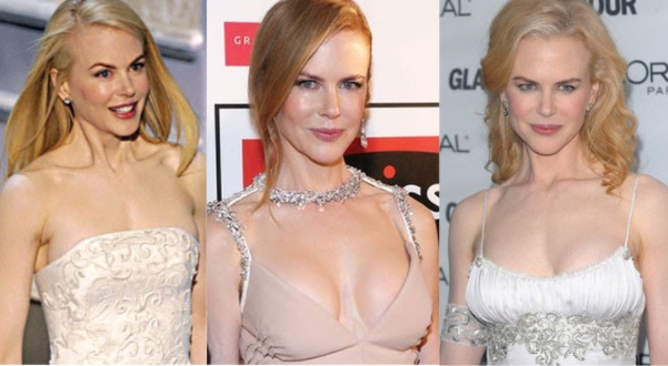 Nicole Kidman chirurgie esthétique