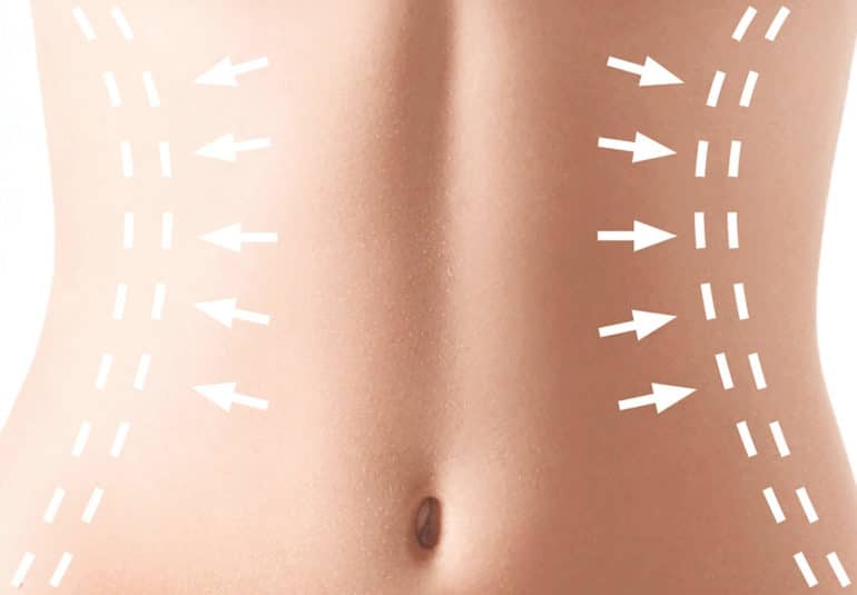 Abdominoplastie Tunisie - chirurgie esthétique du ventre