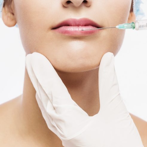 Injection d'Acide Hyaluronique - Medecine esthetique Tunisie