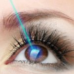 Lasik Tunisie - Chirurgie ophtalmologique Tunisie
