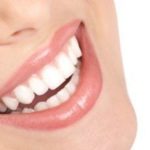 Chirurgie dentaire Tunisie - Blanchiment dentaire