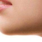 Génioplastie Tunisie - Chirurgie Visage Tunisie