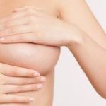 Reduction mammaire Tunisie - Chirurgie mammaire
