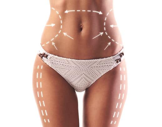 Cryolipolyse Tunisie - Coolsculpting