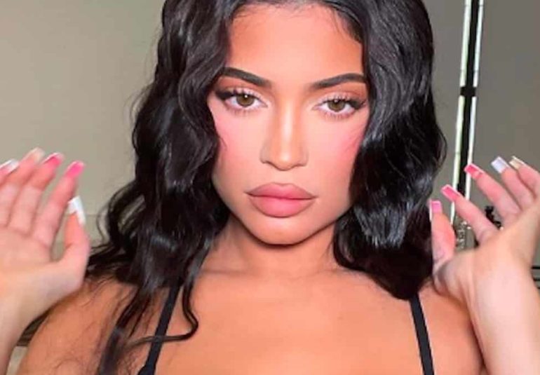 Kylie Jenner après chirurgie esthétique