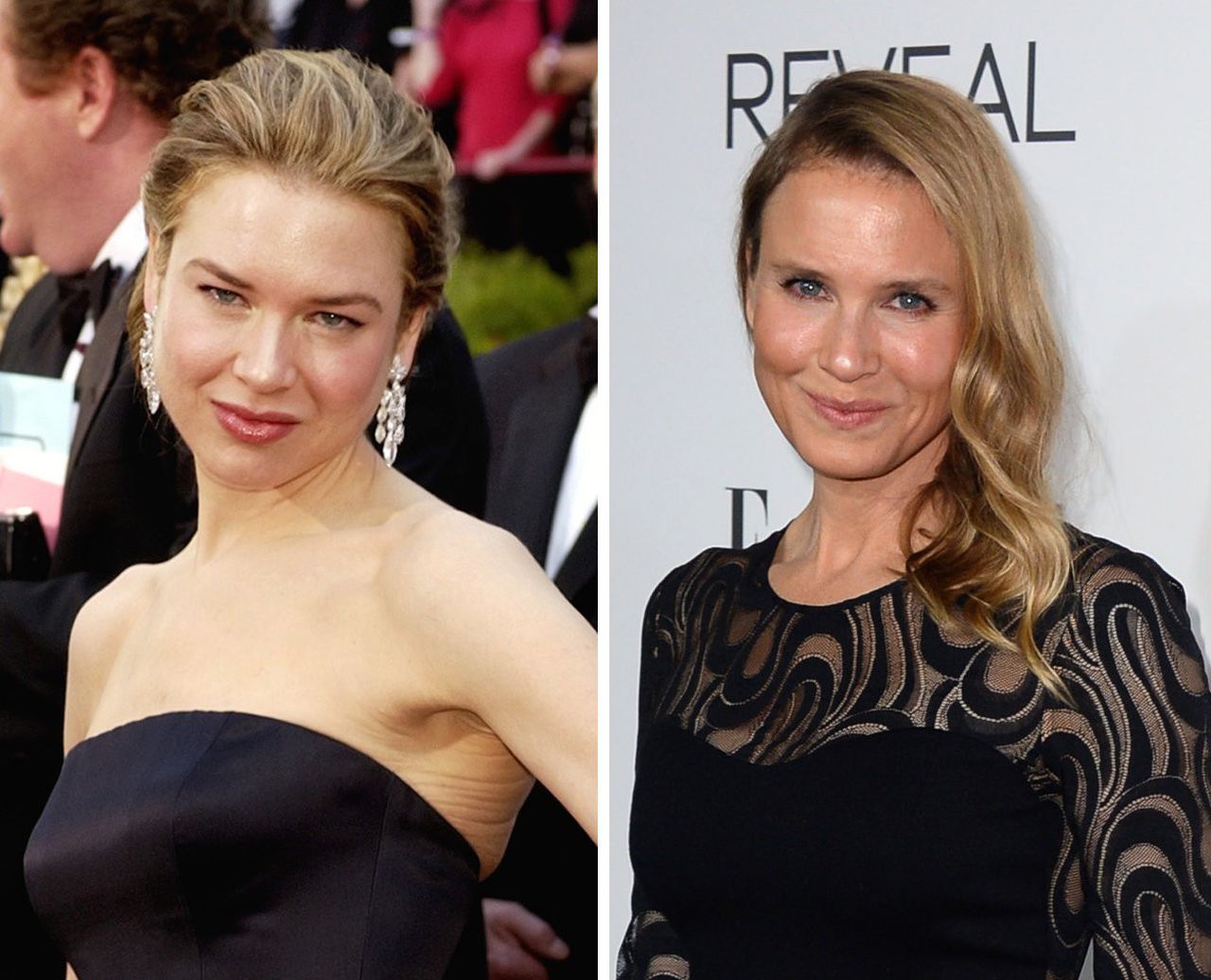 Renée Zellweger Les Chirurgies Esthétiques Quelle A Subi