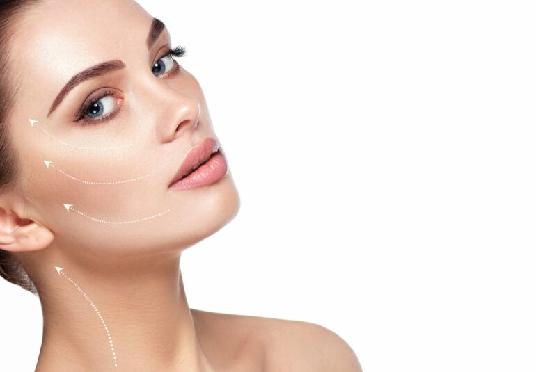 Fils tenseurs ou lifting sans chirurgie