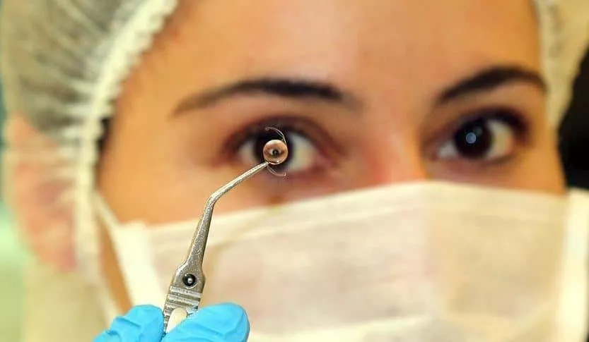 Lentille intraoculaire Tunisie - Implant oculaire