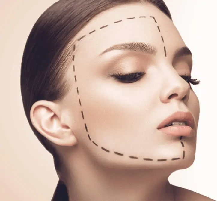 Génioplastie Tunisie chirurgie esthétique du visage