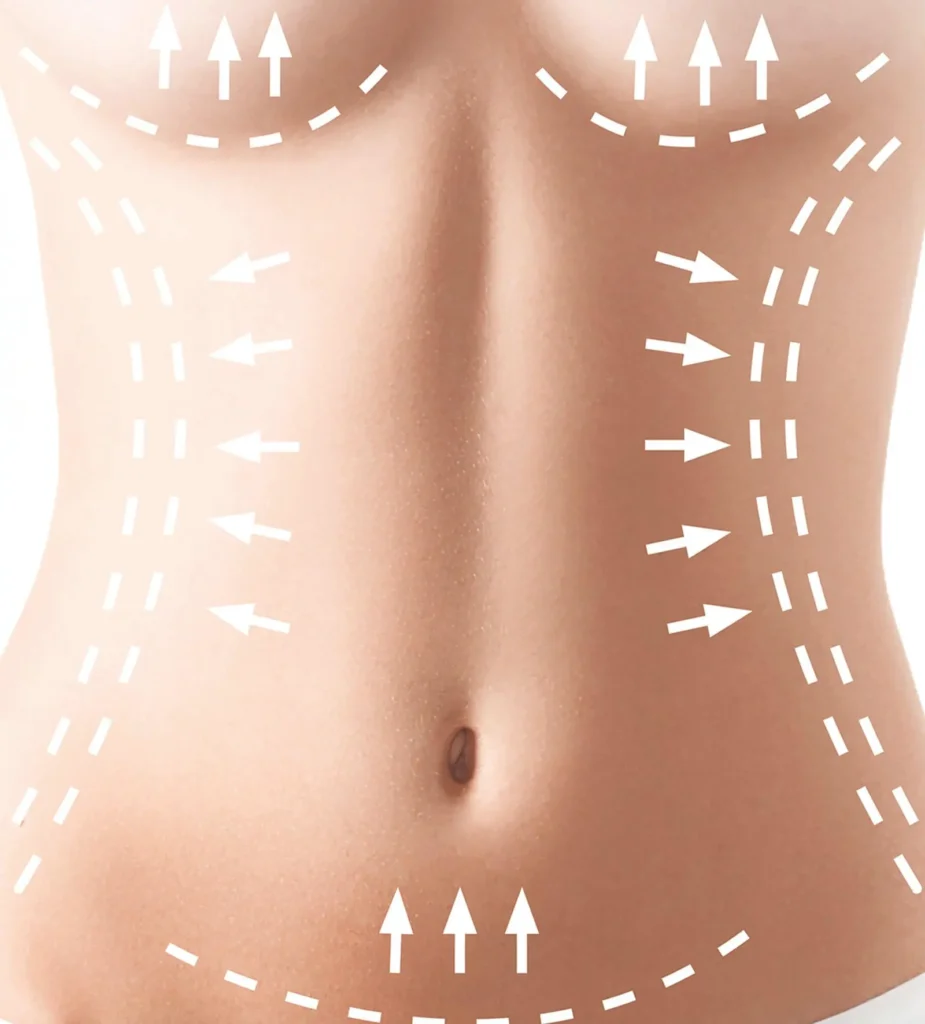 Abdominoplastie Tunisie - chirurgie esthétique du ventre