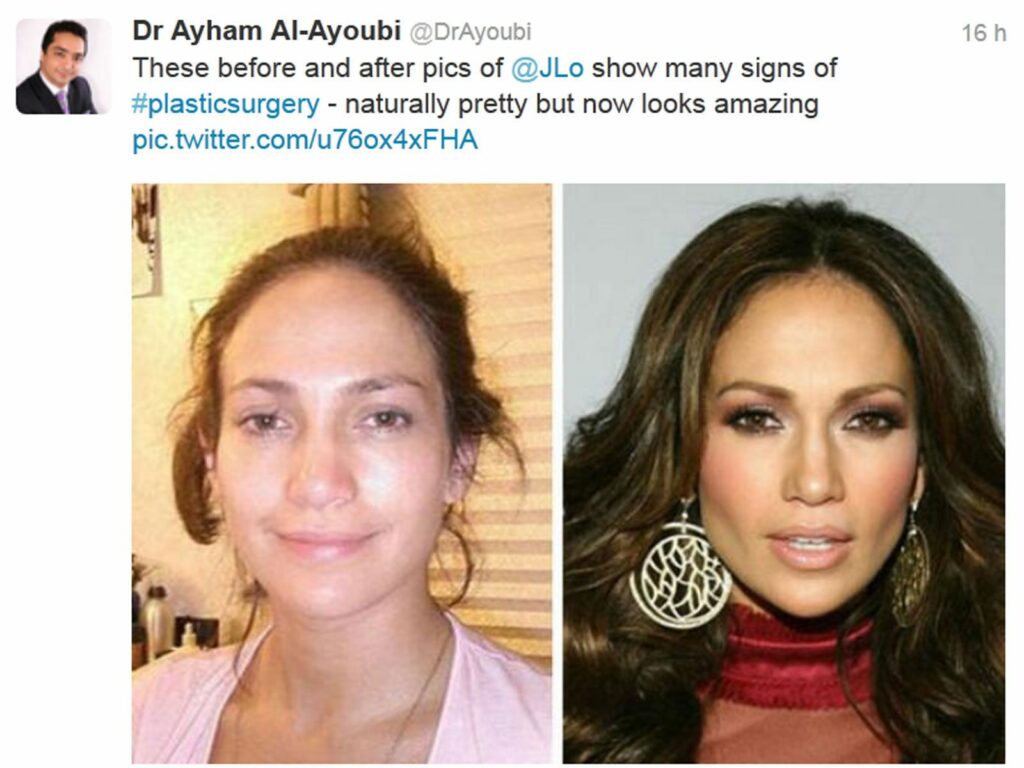 Avis chirurgien plastique sur le visage de Jennifer Lopez