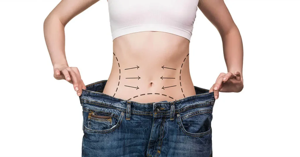 Chirurgie de l'obésité - Chirurgie bariatrique