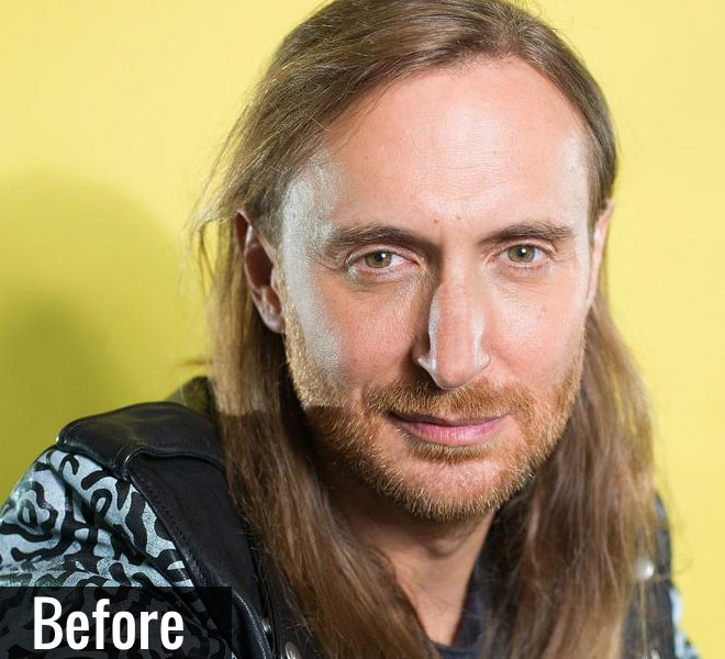 David Guetta avant rhinoplastie