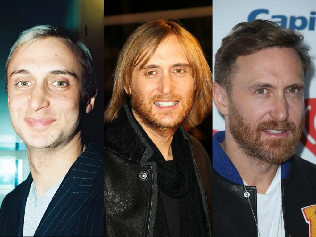 David Guetta chirurgie esthétique