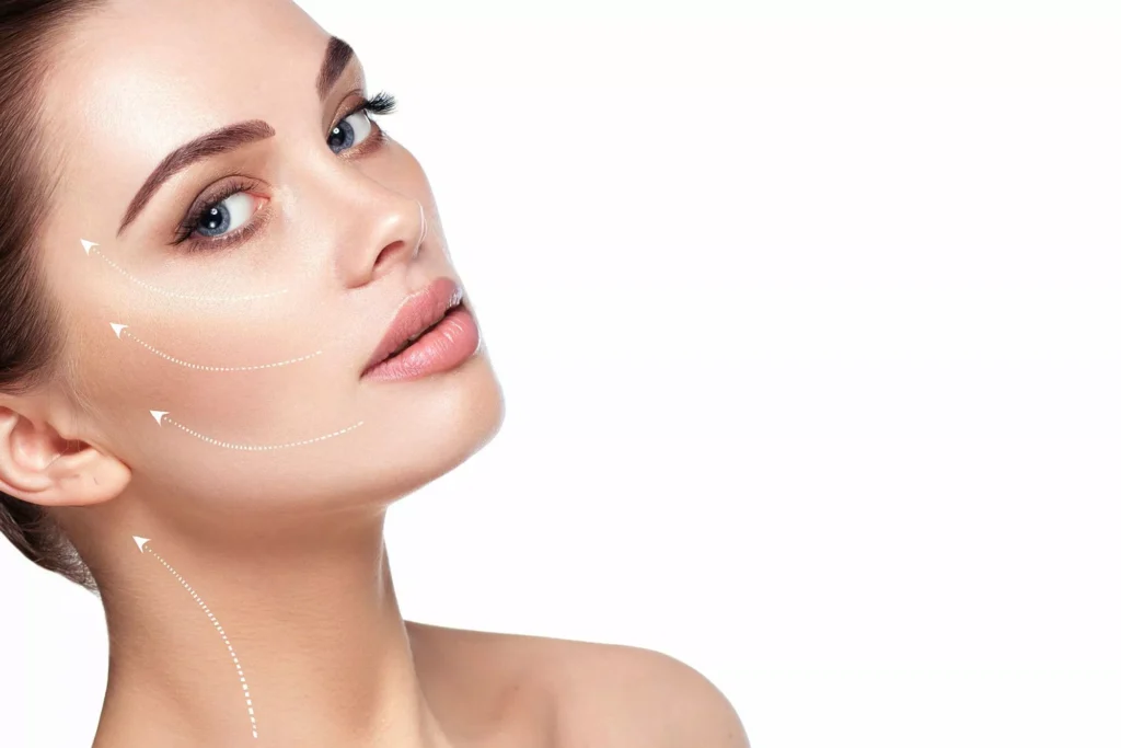 Fils tenseurs ou lifting sans chirurgie