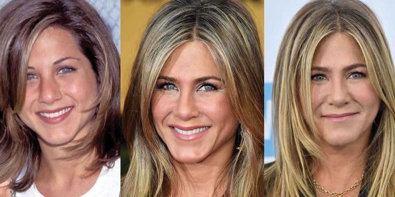 Jennifer Aniston avant/après chirurgie esthétique