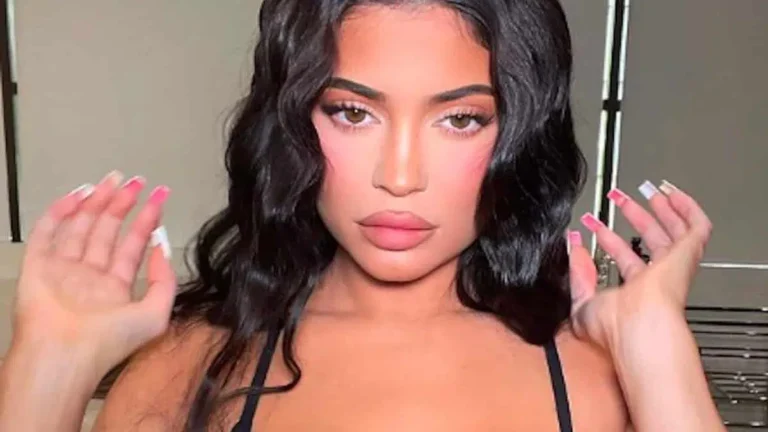 Kylie Jenner après chirurgie esthétique