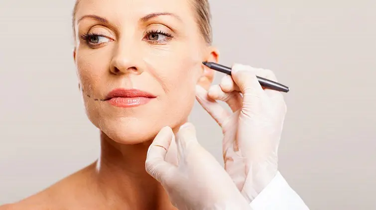 Lifting visage - Lifting Cervico facial