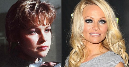Pamela Anderson avant/après chirurgie esthétique
