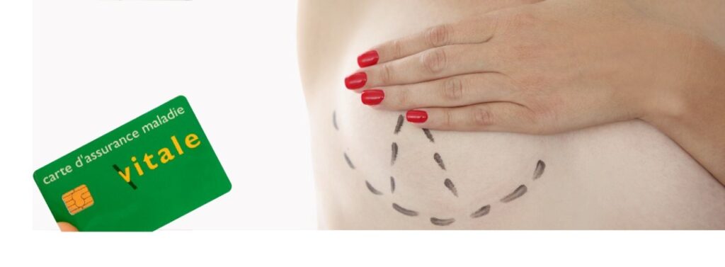 Prise en charge de la réduction mammaire par la sécurité sociale