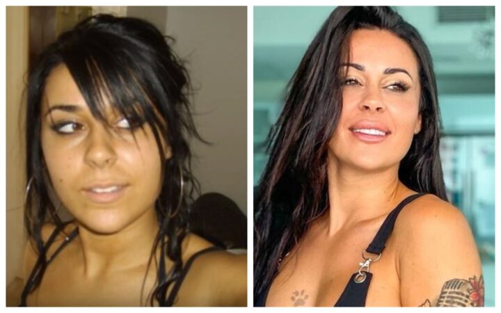 Shanna Kress Avant/après chirurgie esthétique