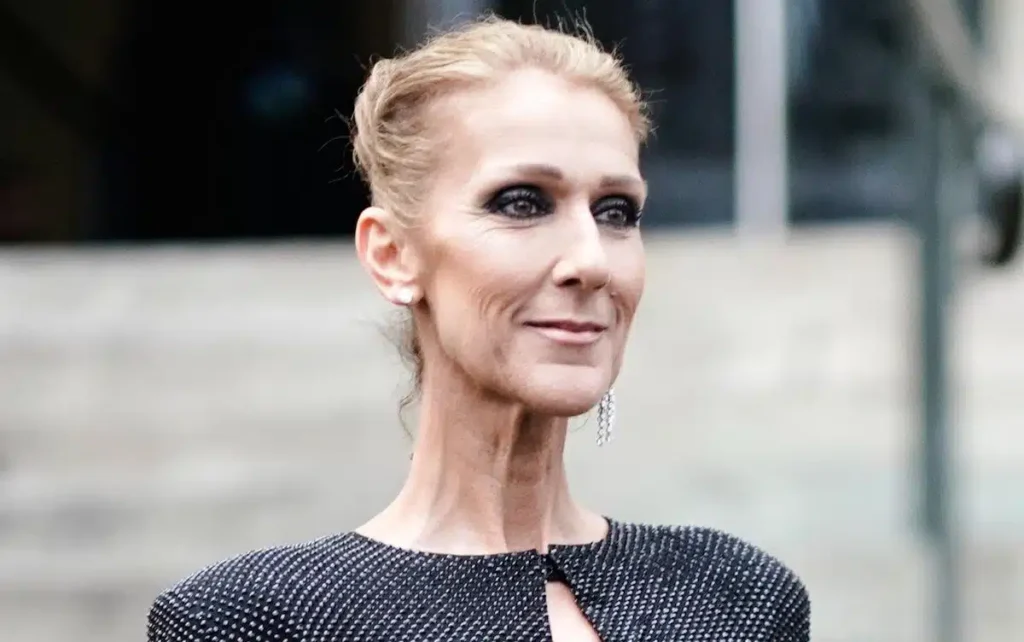 Celine Dion chirurgie esthetique