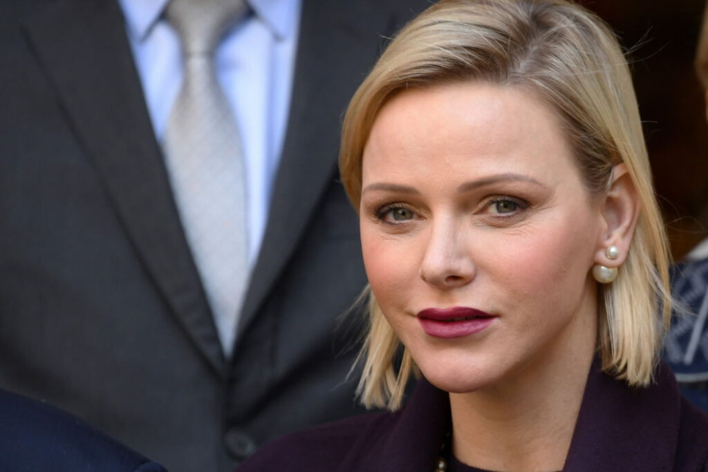 Charlene de Monaco chirurgie esthétique
