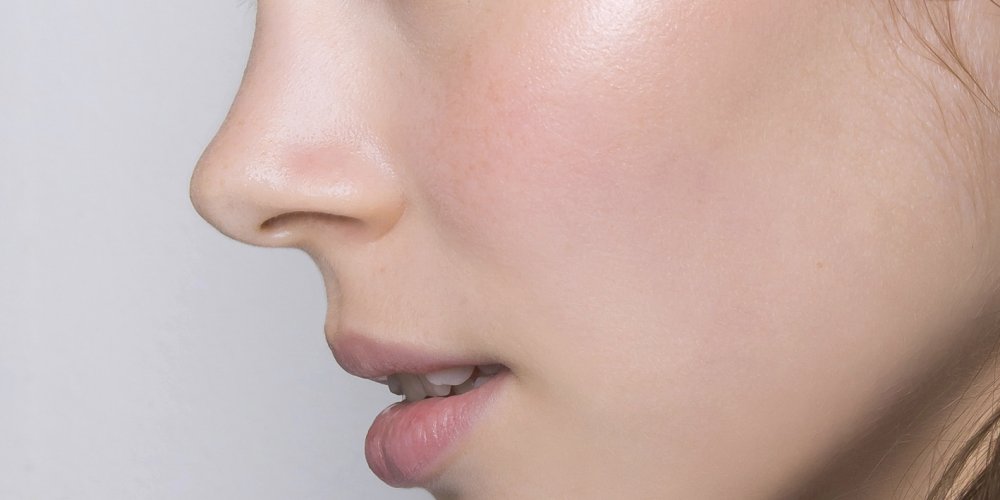Chirurgie rhinoplastie ratée Tunisie