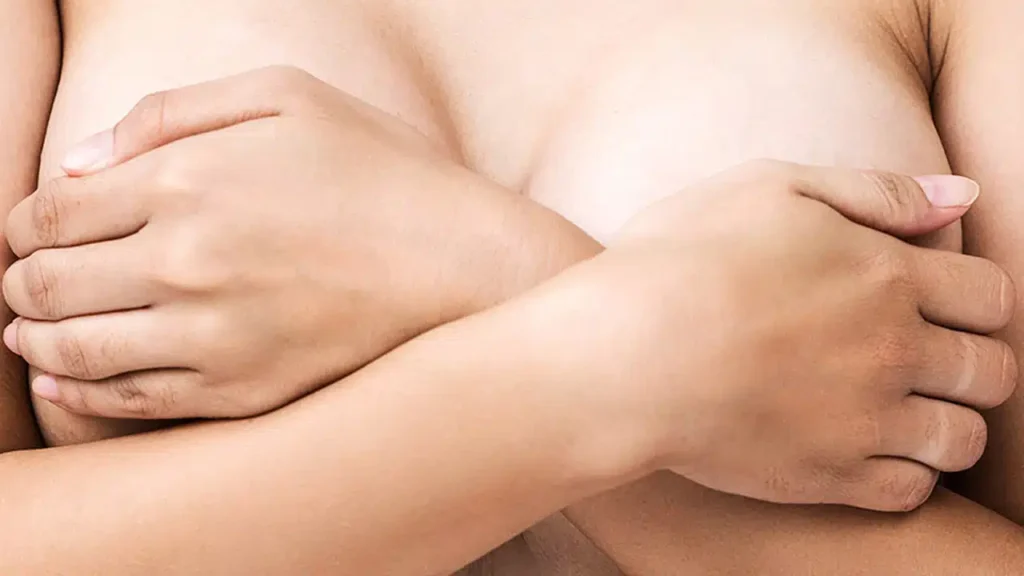 Hypertrophie mammaire