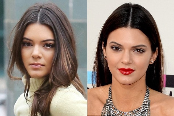 Kendall Jenner chirurgie esthétique du nez avant/après