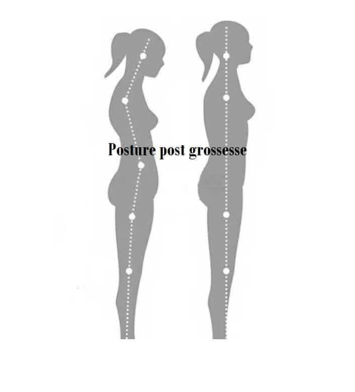 Posture post grossesse