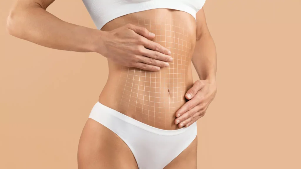 Ventre plus plat grâce à une abdominoplastie