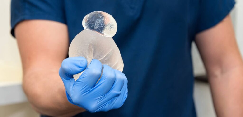 Prothèses Mammaires à Vie