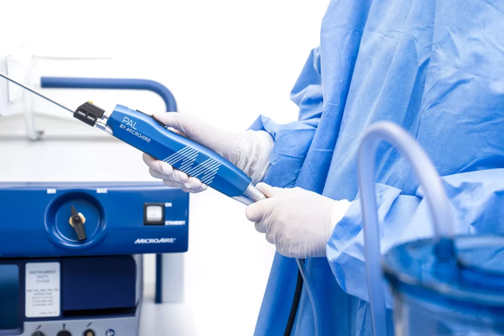 Liposuccion avec technologie Microaire