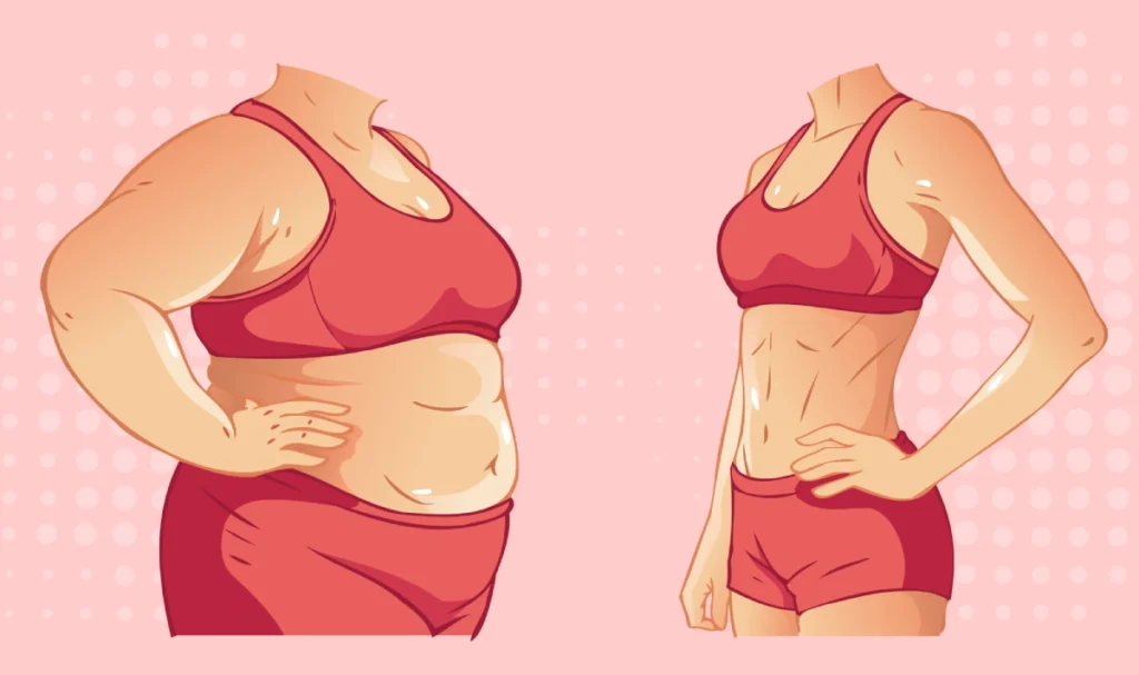 Chirurgie réparatrice post-obésité