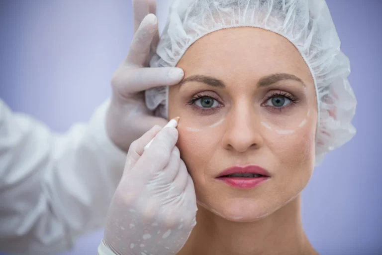 Blépharoplastie en Turquie