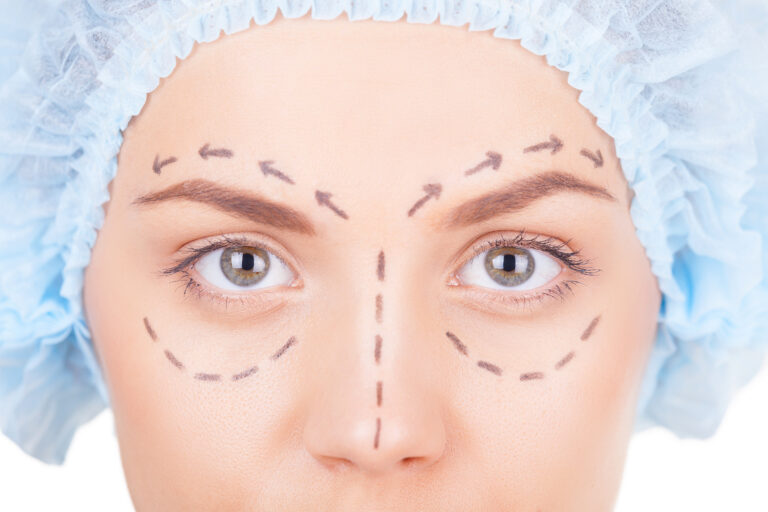 Blépharoplastie en Turquie