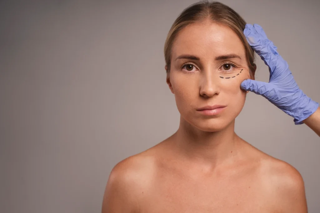 Blépharoplastie en Turquie