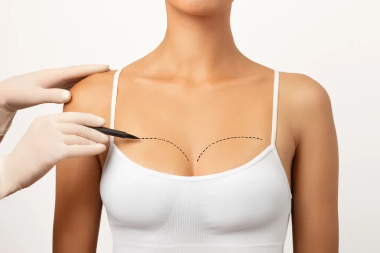 Lipofilling mammaire en Turquie