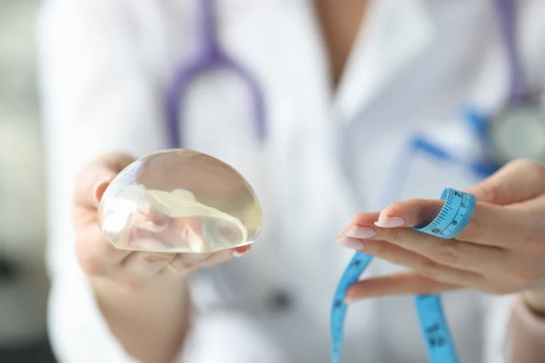Réduction des implants mammaires