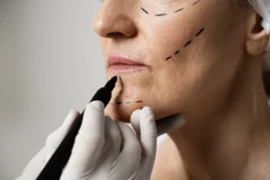 Chirurgie esthétique