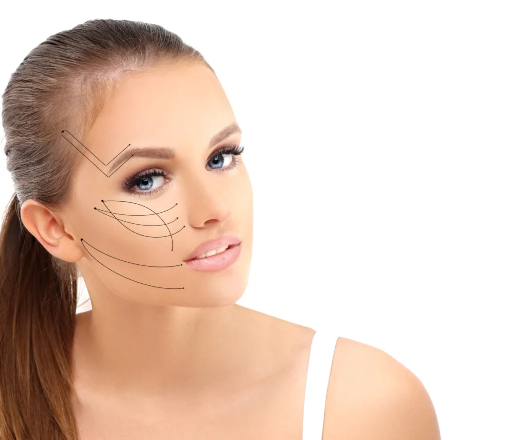 Le lifting endoscopique