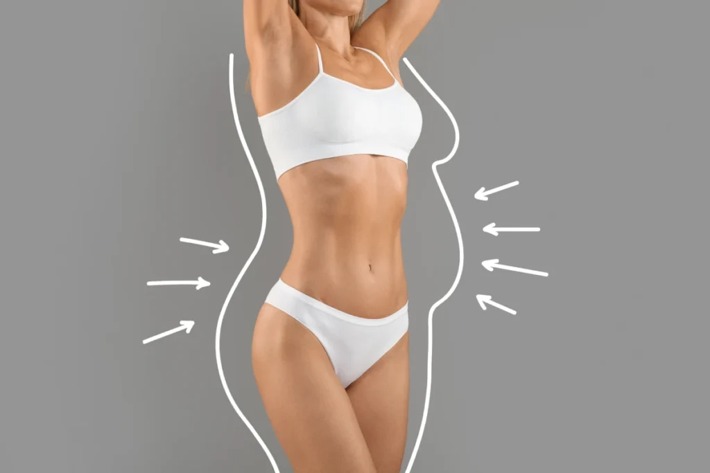 Liposculpture avant après