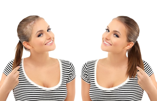 Before and after otoplasty surgery showing correction of prominent ears