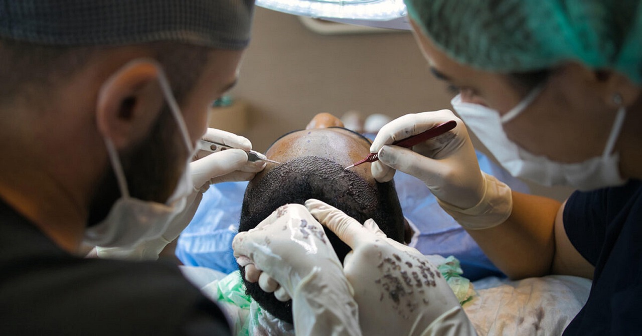 Patient having a hair transplant FUE procedure in a modern clinic in Tunisia