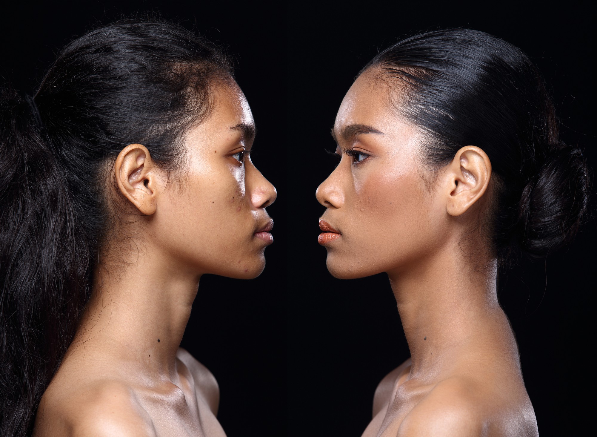 Surgeon performing ethnic rhinoplasty in Tunisia with natural results