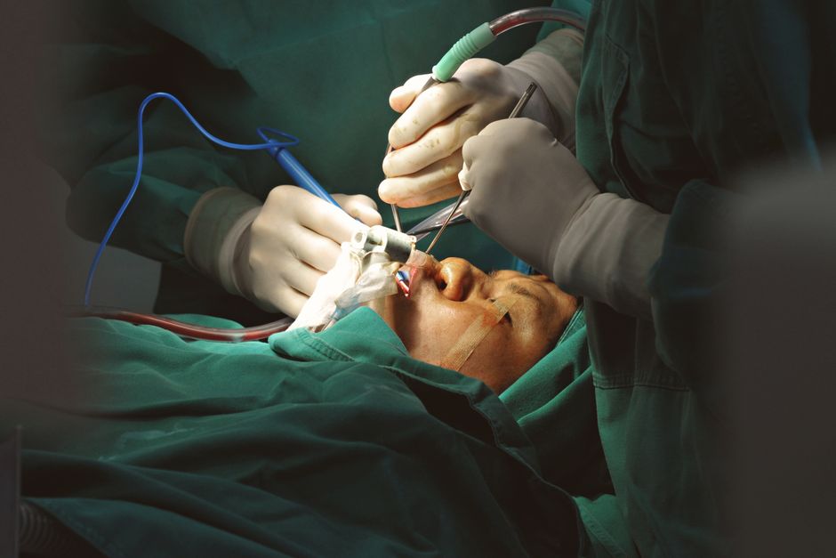 Before and after photos of cosmetic surgery results in Tunisia showing rhinoplasty, breast augmentation, liposuction and facelift