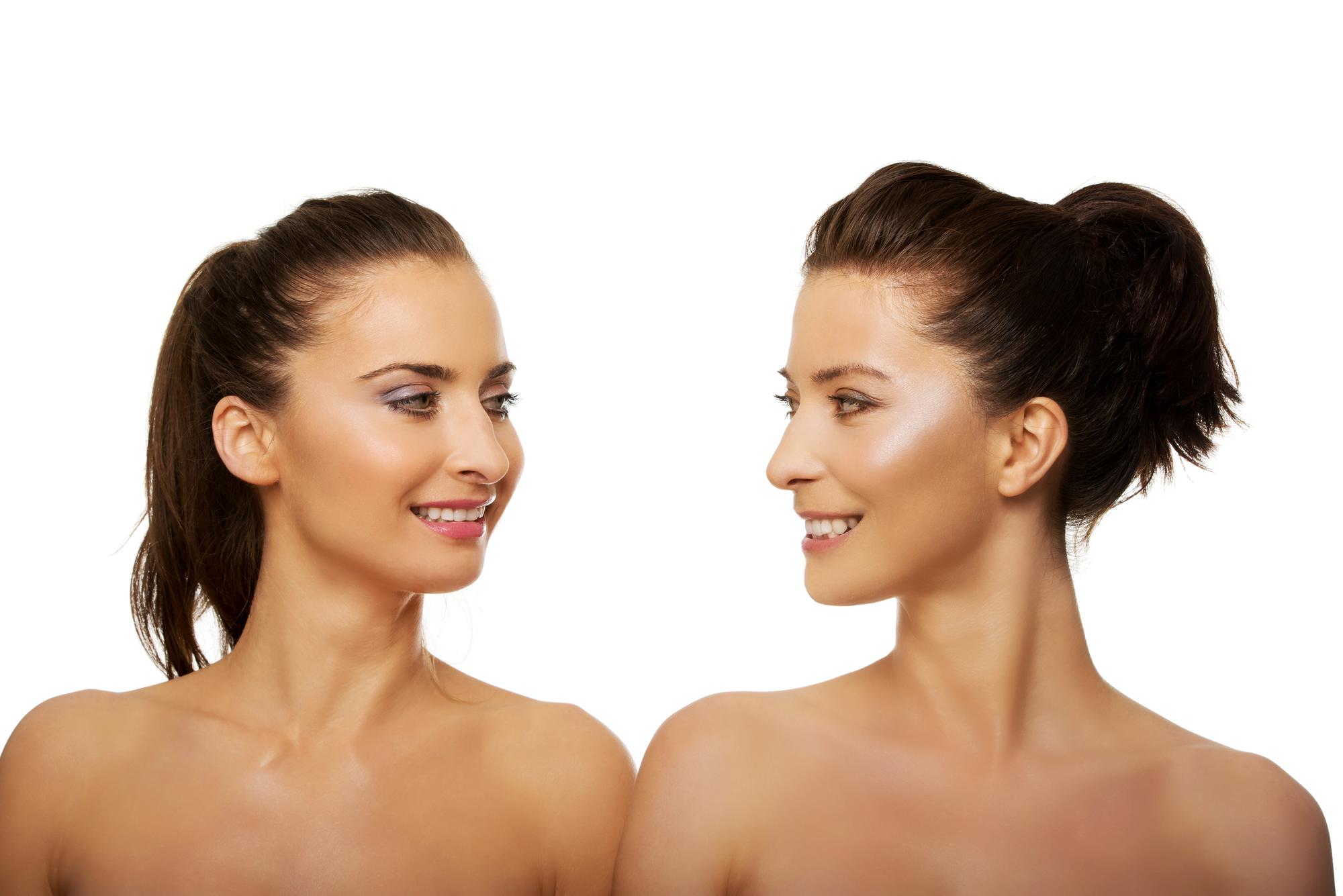 cirugia de papada laser procedure in Tunisia before and after results