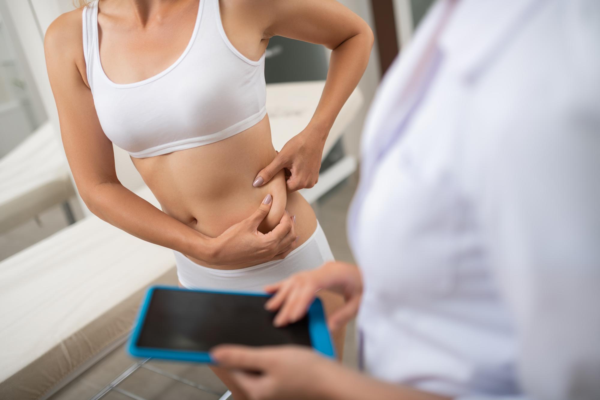 Patient before and after liposuction abdomen in Tunisia with Med Assistance package 2026