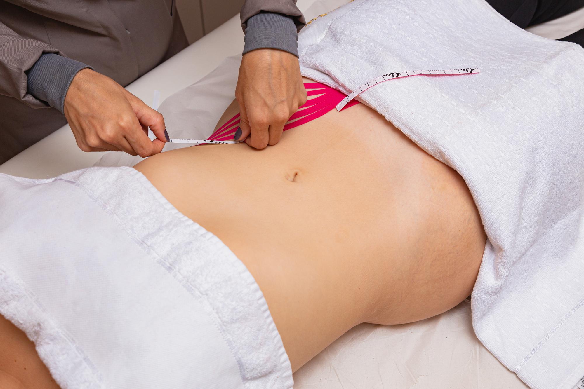 Chirurgien réalisant une liposuccion abdominale en Tunisie, patiente en consultation préopératoire